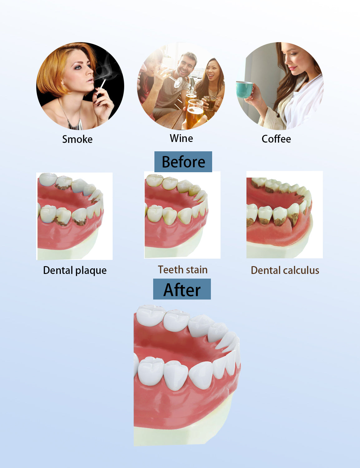 Beavo Ultrasonic Teeth Cleaner Dental Calculus Remover