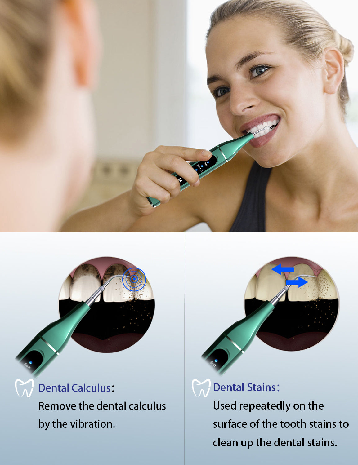 Beavo Ultrasonic Teeth Cleaner Dental Calculus Remover